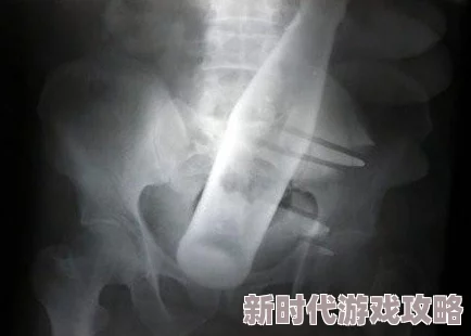 学校要求戴肛塞学生家长反映校方强制推行此项规定引发强烈争议 学校要求戴肛塞学生家长反映校方强制推行此项规定引发强烈争议